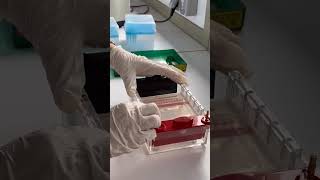 ‏Gel electrophoresis شرح قصير [upl. by Hadden403]