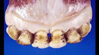 Gross Path of the GI System 3  Teeth [upl. by Otilia746]