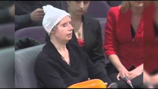 Chimp Attack Victim Speaks to CT Lawmakers [upl. by Wernher557]