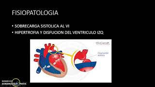 COARTACION AORTICA [upl. by Eddie]