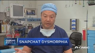 Snapchat dysmorphia Increase in patients seeking Snapchat filter look [upl. by Santiago769]