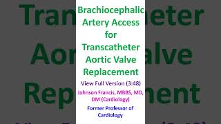 Brachiocephalic Artery Access for Transcatheter Aortic Valve Replacement [upl. by Mistrot204]