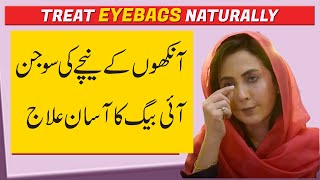 How to Treat Eyebags Problem Naturally  Dr Umme Raheel [upl. by Evin]