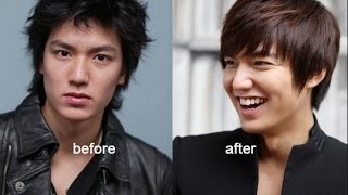 Lee Min Ho Before And After Plastic Surgery [upl. by Philana470]