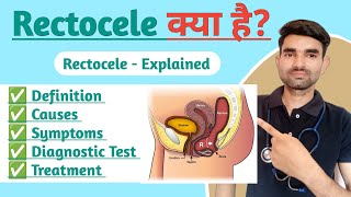 Rectocele Explained in Hindi  Causes Symptoms And Treatment of Rectocele [upl. by Enywad]