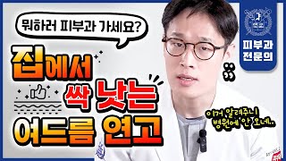 여드름 났을 때 피부과 가지 말고 집에서 quot이것quot만 바르면 싹 좋아집니다  처방 없이도 싹 낫는 여드름연고 추천 [upl. by Airda]