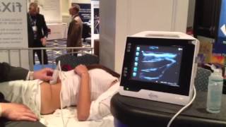 Ultrasound Guided Illeoingunal Nerve Block [upl. by Adlih]