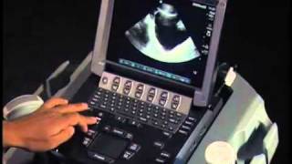 How To Ultrasound FAST Exam  Male Pelvis [upl. by Tham]