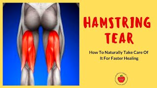 Hamstring Tear SelfCare [upl. by Aihsat]