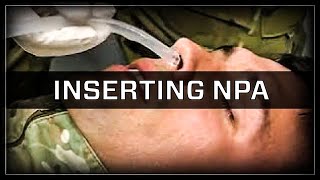 Inserting a Nasopharyngeal Airway NPA [upl. by Anilorak259]