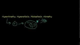 2  Introduction to pathology  hypertrophy hyperplasia [upl. by Lein]