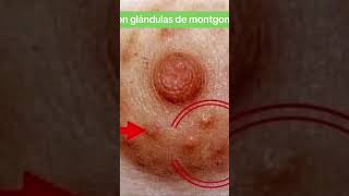 Glándulas de Montgomery medicina usmle enarm anatomia enfermería [upl. by Byler]