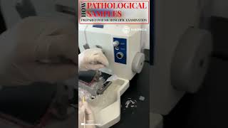 How are your Pathological Samples prepared for Microscopic Examinationmedical medicine shorts [upl. by Ahsropal]