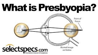 What is Presbyopia With SelectSpecscom [upl. by Glantz]