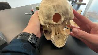 Skull Frontal Parietal and Occipital Bone and their bone markings [upl. by Barrett]