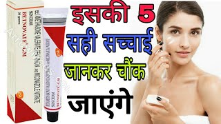 Betnovate GM cream review in Hindi  Betnovate GM cream review Betnovate GM cream [upl. by Tedman]