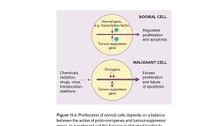 LYMPHOID NEOPLASMS Lecture 5 By Dr Rafiq Cheema Class 4th year [upl. by Spiegelman176]