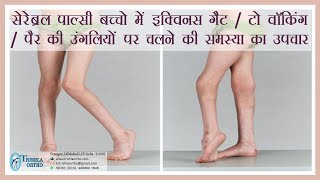 Treatment of Equinus gait toe walking walking on toes in cerebral palsy treatment at Trishla [upl. by Noiztneb]