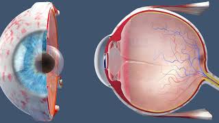 Cataract Surgery  Inside the OR [upl. by Lunsford]