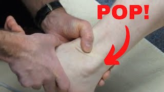 Peroneus longus subluxation How to treat it [upl. by Ody652]