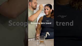 Latte 2 sugars x coffee latte skin vitiligo trend couple coffee lover funny funnyvideo [upl. by Derian]