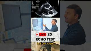 Live 2D Echo cardiography test heart echo live shorts shortsfeed short drkrishvaidya trend [upl. by Dynah327]