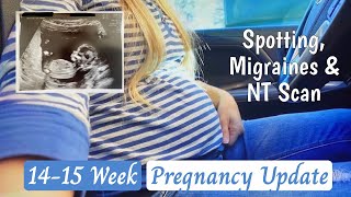 1415 Week Pregnancy Update  Spotting Scare NT Scan amp Migraines [upl. by Liederman587]