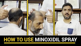 How to use minoxidil spray Method  Doctor Habib Hair Transplant Clinic [upl. by Enram]