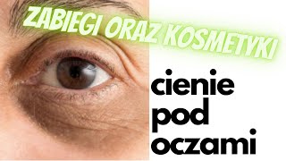 Cienie pod oczami  Rodzaje cieni sposoby jak sobie z nimi radzić [upl. by Noirda527]