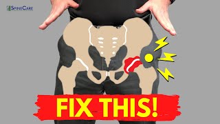 How to Fix a Popping Hip for Good NO EQUIPMENT [upl. by Ecerahc]