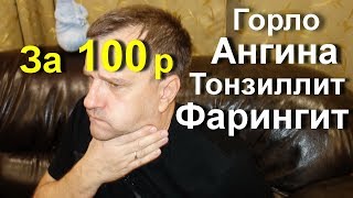 Забытое копеечное средство за 100 р лечение красное горло ангина тонзиллит фарингит Эффект 100 [upl. by Ardell]