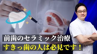 【前歯のすきっ歯】 セラミック治療をする前に警告！ [upl. by Lida]