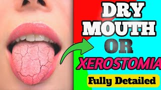 CAUSES OF XEROSTOMIA  MANGEMENT  DRY MOUTH 😍 [upl. by Gmur]