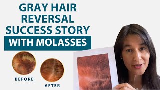 Gray Hair Reversal Success Story  Proof  With Blackstrap Molasses [upl. by Finkelstein]