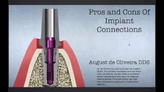 Dental Education The Evolution of Implant Connections Feb 15 2017 [upl. by Arracot81]