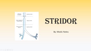 Stridor  acutechronic causes Bernoulli principle clinical features investigations management [upl. by Carlile]