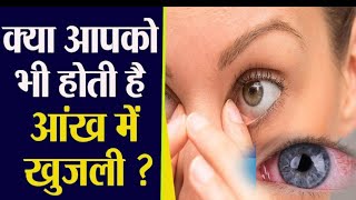 mahaflox  eye ointment  moxifloxacin eye ointment  eye itching  eye redness problem solve [upl. by Dwane]