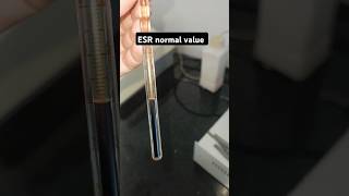 ESR Erythrocyte Sedimentation rate 🩸🩸🧑‍🔬💉blood infectionTest normal valueamp result status shorts [upl. by Delfeena]