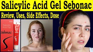 Salicylic Acid Gel Sebonac  Salicylic Acid Gel Review  uses Side Effects Dose How to use [upl. by Sclar448]