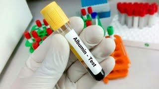 Serum Albumin test Introduction Normal range purpose Procedure High and Low causes [upl. by Nivaj]