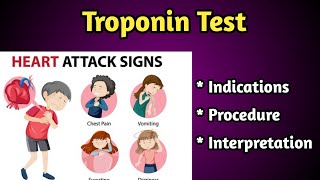 Troponin Test for Heart Procedure Detailed Video [upl. by Ecirad]