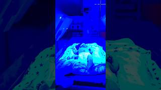 neonataljaundice hospital newborn doctor pediatrics phototherapyjaundicebaby phototherapy [upl. by Reisch355]