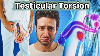 Testicular Torsion  What Happens in Testicular Torsion  Symptoms Causes And Treatment UrduHindi [upl. by Obau792]