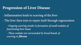 Liver Disease  Fibrosis [upl. by Macmillan]