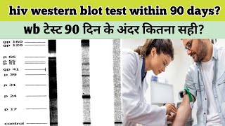 when we should go with western blot test for hiv western blot test accuracy within 90 days [upl. by Ailliw90]