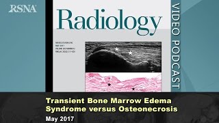 Transient Bone Marrow Edema Syndrome versus Osteonecrosis May 2017 Radiology [upl. by Largent764]