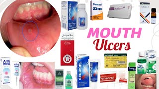 mouth ulcers Aphthous ulcers [upl. by Olnay]