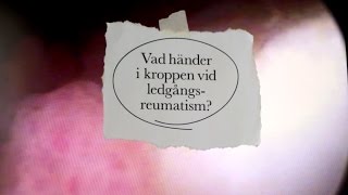 Vad händer i kroppen vid ledgångsreumatism [upl. by Daza261]