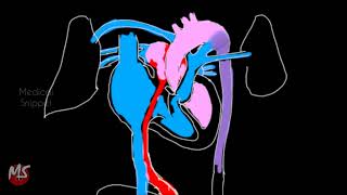 Fetal Circulation  Anatomy  Made easy  3 minutes [upl. by Clyde]