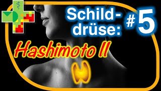 Hashimoto II Diagnostik  was ist zu beachten [upl. by Ahsilrae58]